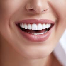 What Are Dental Veneers in Sydney? Cost, Procedure & Advantages