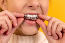 5 Ways to Prepare for Your First Orthodontic Appointment in Las Vegas