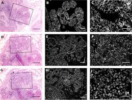The Impact of FFPE Tissue Preservation on Immunohistochemistry Precision