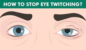 Main Factors that Trigger Right Eye Blinking or Twitching